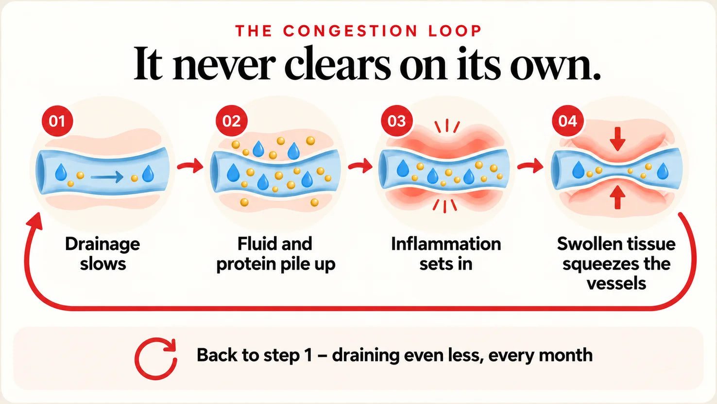 The congestion loop: drainage slows, fluid and protein pile up, inflammation sets in, swollen tissue squeezes the vessels, and it starts again.