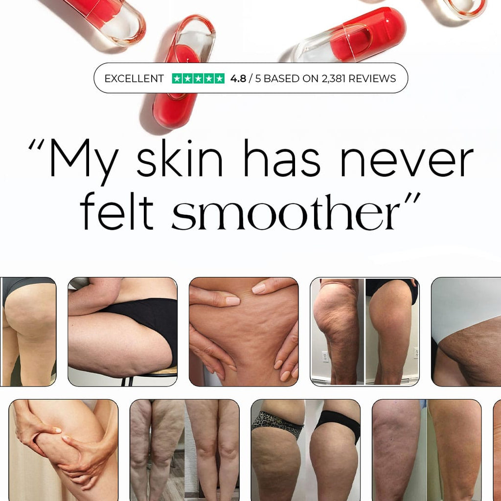 Anti-Cellulite & Lipedema Capsules | Sculptique™ Smooth Skin