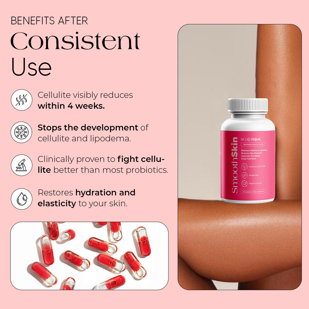New Maximum Potency Anti-Lipedema Capsules | Smooth Skin by Sculptique™