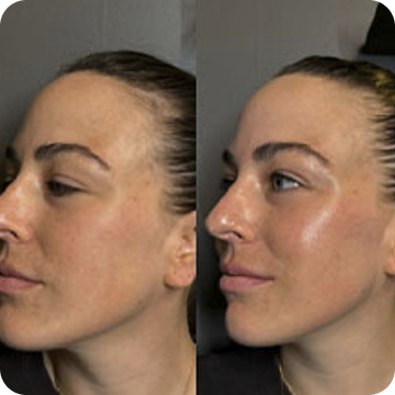 The Transformation